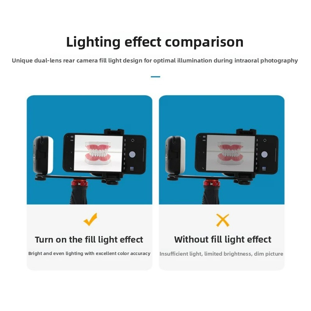 Tandheelkundige fotografielamp - Photography Lighting Kit recensie en prijs
